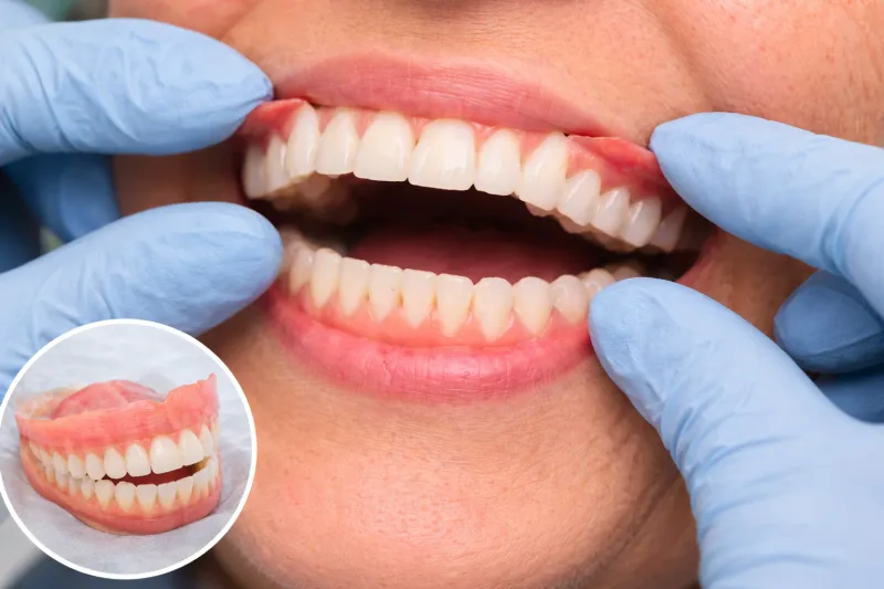 Dentures at Carewell Dental